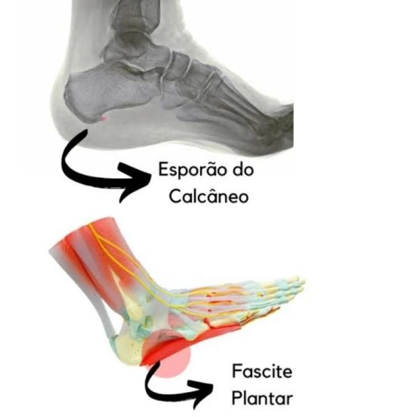 Ortopedico Chinelo confortável feminino sandália massageadora nuvem. - Imagem 2